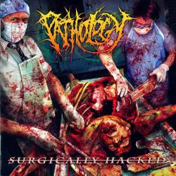 Pathology (USA) : Surgically Hacked